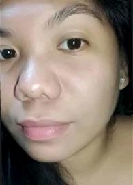 ynl